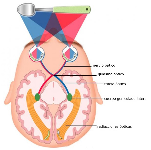 Diagrama de la cabeza por encima de los ojos y cerebro, identificando nervio óptico, quiasma óptico, tracto óptico, núcleo geniculado lateral y radiación óptica